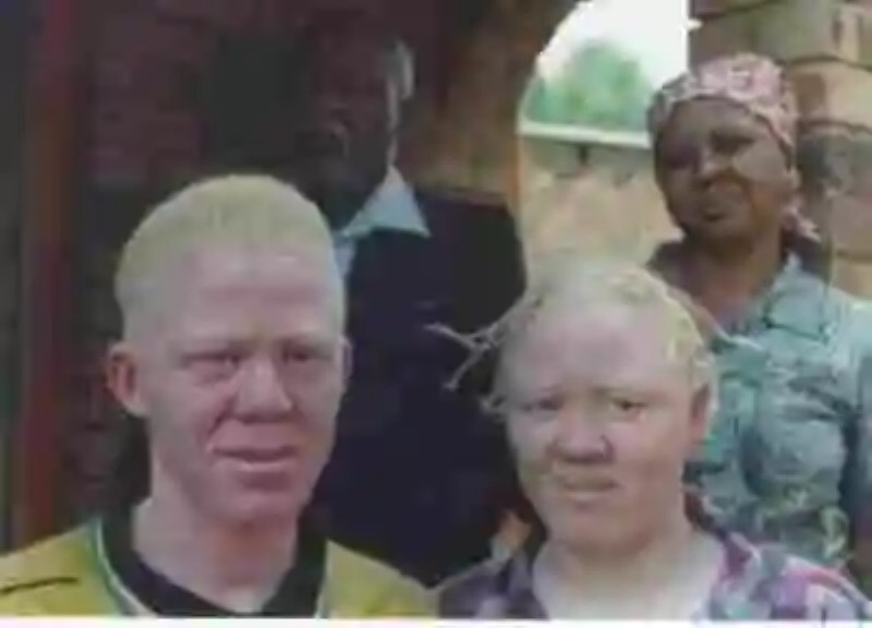 La desgracia de ser albino en Tanzania