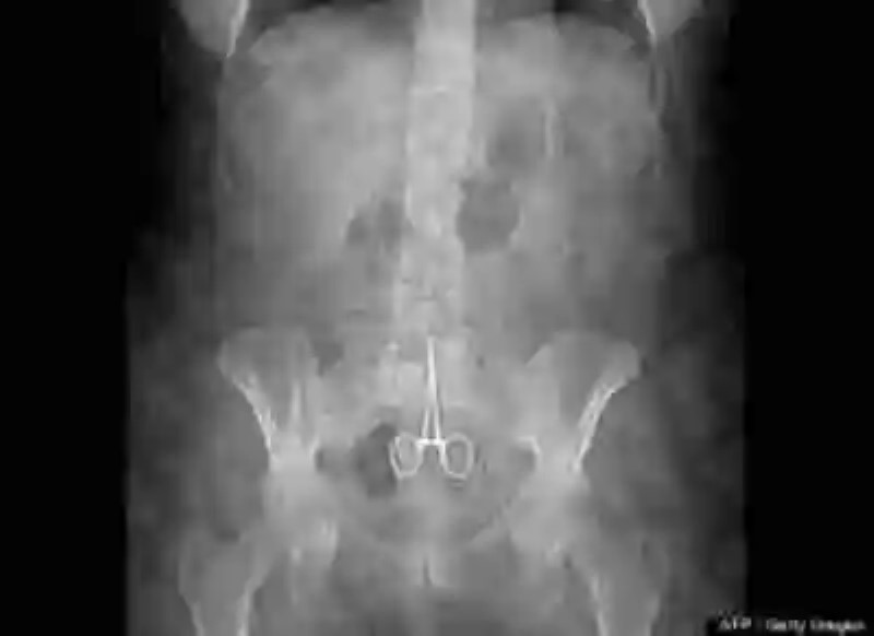 Objetos detectados por los rayos x en el interior del cuerpo