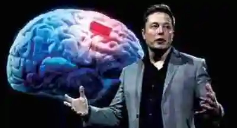Neuralink: el proyecto de Elon Musk para conectar nuestros cerebros a un computador