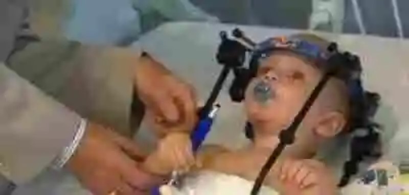 Médicos le “recolocan” la cabeza a un niño que fue “decapitado internamente”
