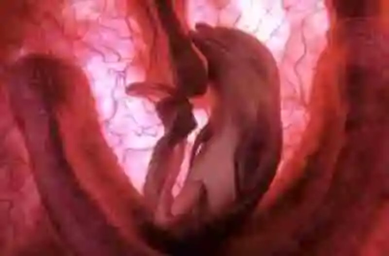 «In the womb», fetos animales en el vientre materno