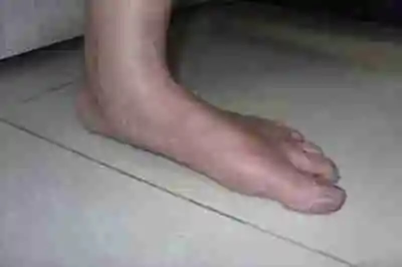 El hombre con los pies más grandes del mundo