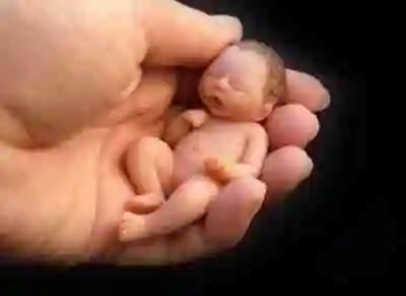 El bebe más pequeño del mundo